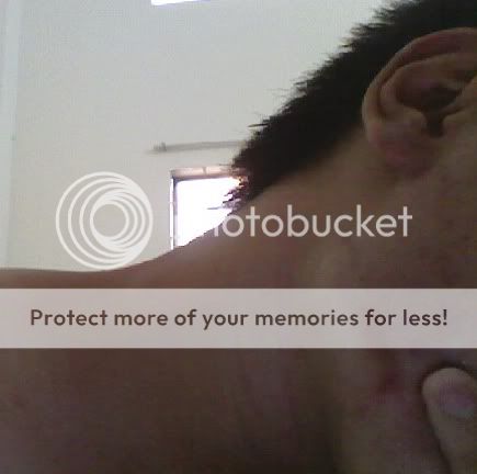 Em bị gì thế mấy bác? - 1